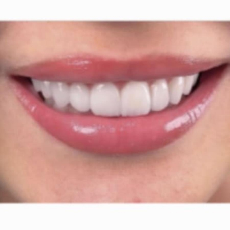 Keaece  oaeo aca  Eaeype